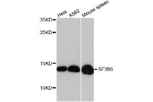 Western blot analysis of extracts of various cell lines, using SF3B6 antibody (ABIN6290152) at 1:3000 dilution. (Pre-mRNA Branch Site Protein p14 (SF3B14) Antikörper)
