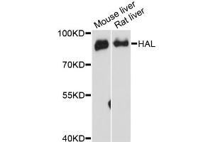 Western blot analysis of extracts of various cell lines, using HAL antibody (ABIN6292128) at 1:3000 dilution.