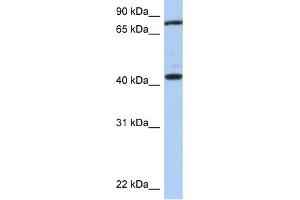 WB Suggested Anti-TEX9 Antibody Titration: 0. (TEX9 Antikörper  (Middle Region))