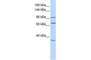 EEF2 antibody used at 1 ug/ml to detect target protein. (EEF2 Antikörper  (N-Term))