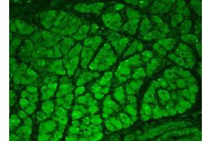 CaMKII Immunofluorescence. (CAMK2A Antikörper)