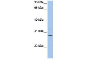 WB Suggested Anti-PEMT Antibody Titration:  0. (PEMT Antikörper  (C-Term))