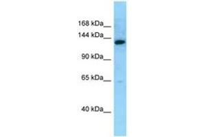 Image no. 1 for anti-MN1 proto-oncogene (MN1) (AA 1249-1298) antibody (ABIN6748132) (Meningioma 1 Antikörper  (AA 1249-1298))