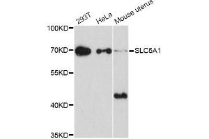 Western blot analysis of extracts of various cell lines, using SLC5A1 Antibody (ABIN5998870) at 1/1000 dilution. (SLC5A1 Antikörper)