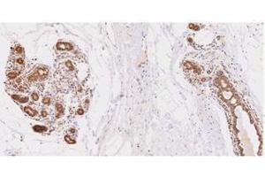 Immunohistochemistry (IHC) image for anti-Ubiquitin-Conjugating Enzyme E2L 6 (UBE2L6) (AA 1-152), (N-Term) antibody (ABIN317575) (UBE2L6 Antikörper  (N-Term))