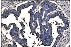 IHC analysis of Ornithine Aminotransferase/OAT using anti-Ornithine Aminotransferase/OAT antibody (ABIN7600649). (OAT Antikörper  (AA 214-439))