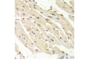 Immunohistochemistry of paraffin-embedded mouse heart using PSME1 antibody (ABIN1876546) at dilution of 1:100 (40x lens). (PSME1 Antikörper)