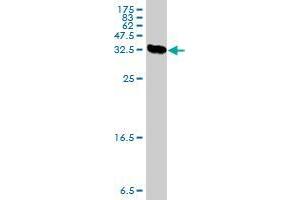 Western Blot detection against Immunogen (37. (PRKCDBP Antikörper  (AA 161-261))