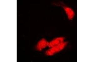 Immunofluorescent analysis of SULT2B1 staining in A549 cells. (SULT2B1 Antikörper)