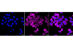 Immunocytochemical staining of HepG2 cells with Fragile X messenger ribonucleoprotein 1 antibody (ABIN7800930), 1:1,000). (Rekombinanter Fragile X Messenger Ribonucleoprotein 1 Antikörper)
