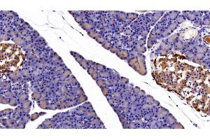 Immunohistochemistry (IHC) image for anti-Keratin 7 (KRT7) (AA 91-394) antibody (ABIN7432025)