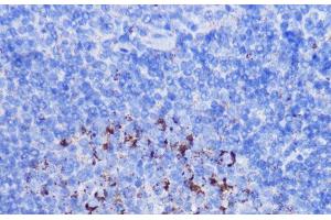 Immunohistochemistry (Paraffin-embedded Sections) (IHC (p)) image for anti-NADH Dehydrogenase (Ubiquinone) 1 beta Subcomplex, 7, 18kDa (NDUFB7) antibody (ABIN7257309)