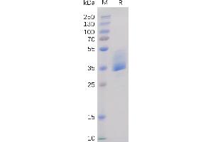SDS-PAGE (SDS) image for Tumor Necrosis Factor Receptor Superfamily, Member 13C (TNFRSF13C) (AA 7-71) protein (mFc Tag) (ABIN6961114)