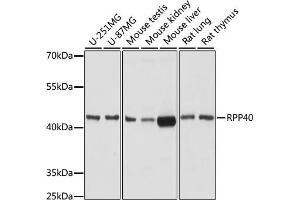 Western blot analysis of extracts of various cell lines, using RPP40 antibody (ABIN7269984) at 1:1000 dilution. (RPP40 Antikörper  (AA 130-210))