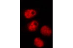 ABIN6268905 staining HeLa by IF/ICC. (OCT4 Antikörper  (Internal Region))
