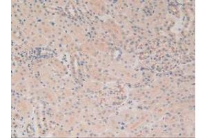 Figure. (MAP4 Antikörper  (AA 2-250))