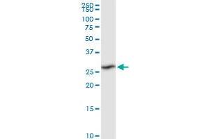 Western Blotting (WB) image for anti-Ribose 5-Phosphate Isomerase A (RPIA) (AA 1-237) antibody (ABIN524871)