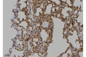 ABIN6268990 at 1/100 staining Mouse lung tissue by IHC-P. (PPP1R12A Antikörper  (C-Term))