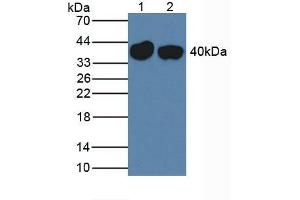 Western blot analysis of (1) Mouse Liver Tissue and (2) Rat Liver Tissue. (SERPINA7 Antikörper  (AA 127-393))