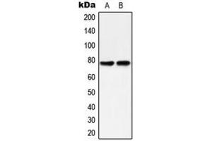 Western blot analysis of PKC delta (pY313) expression in HeLa (A), MCF7 Caylculin A-treated (B) whole cell lysates. (PKC delta Antikörper  (pTyr313))