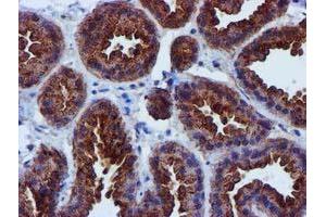 Immunohistochemical staining of paraffin-embedded Human breast tissue using anti-EPN2 mouse monoclonal antibody. (Epsin 2 Antikörper)