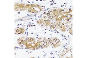 Immunohistochemistry (Paraffin-embedded Sections) (IHC (p)) image for anti-Natriuretic Peptide A (NPPA) (AA 26-151) antibody (ABIN3022234)