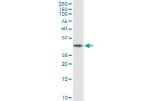 HADH MaxPab rabbit polyclonal antibody. (HADH Antikörper  (AA 1-314))