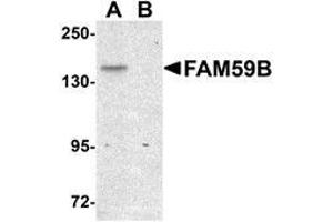 Western blot analysis of FAM59B in SK-N-SH cell lysate with AP30331PU-N FAM59B antibody at 1 μg/ml in (A) the absence and (B) the presence of blocking peptide. (FAM59B Antikörper  (C-Term))