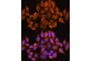 Immunofluorescence analysis of HeLa cells using  Rabbit pAb (ABIN7269965) at dilution of 1:100. (ARHGAP30 Antikörper  (AA 485-585))