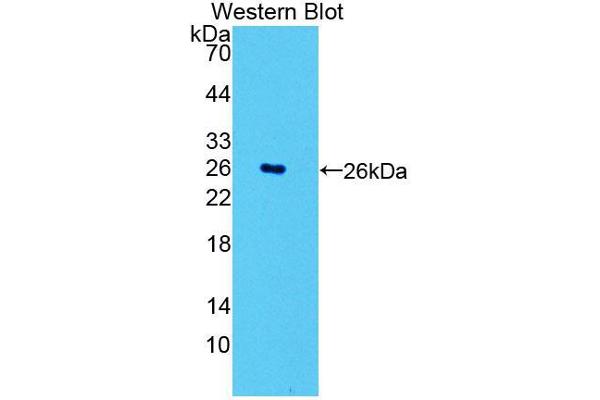 POMT1 Antikörper  (AA 318-513)