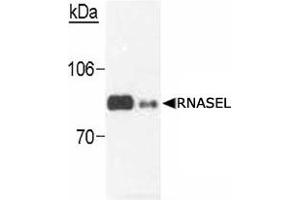 Western blot analysis of RNASEL in transfected cells (0.