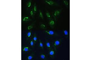 Immunofluorescence analysis of H9C2 cells using NBAS Rabbit pAb (ABIN1680973, ABIN3019188, ABIN3019189 and ABIN6220752) at dilution of 1:100. (NBAS Antikörper  (AA 1-70))