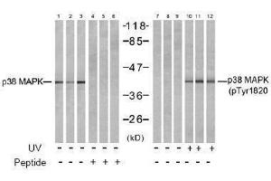 Image no. 2 for anti-Mitogen-Activated Protein Kinase 14 (MAPK14) (pTyr182) antibody (ABIN197012) (MAPK14 Antikörper  (pTyr182))
