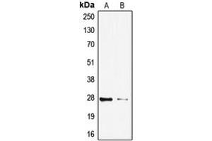Western blot analysis of TP53INP1 expression in HeLa (A), HepG2 (B) whole cell lysates. (TP53INP1 Antikörper  (C-Term))
