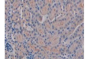 Detection of ITGb3 in Mouse Kidney Tissue using Polyclonal Antibody to Integrin Beta 3 (ITGb3)