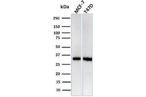 Western Blot Analysis of Human MCF-7, T47D cell lysates using RPA2 Recombinant Rabbit Monoclonal Antibody (RPA2/3140R). (Rekombinanter RPA2 Antikörper)