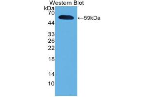Western blot analysis of the recombinant protein. (IFNA5 Antikörper  (AA 22-189))