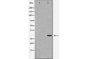 Western blot analysis of SIRT3 expression in Mouse Heart lysate,The lane on the left is treated with the antigen-specific peptide.