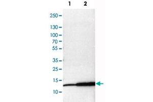 Western Blot analysis of Lane 1: NIH-3T3 cell lysate (mouse embryonic fibroblast cells), Lane 2: NBT-II cell lysate (Wistar rat bladder tumor cells) and Lane 3: PC12 cell lysate (pheochromocytoma of rat adrenal medulla) with MIF polyclonal antibody . (MIF Antikörper)