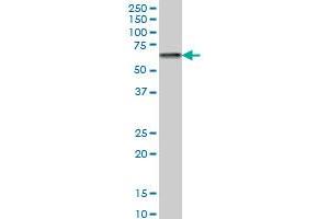 CACNB2 monoclonal antibody (M05), clone 6C4 Western Blot analysis of CACNB2 expression in Hela S3 NE . (CACNB2 Antikörper  (AA 213-301))