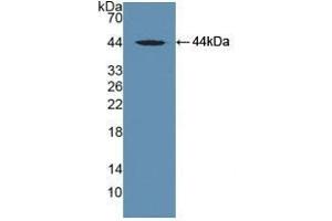 Vitamin D-Binding Protein anticorps  (AA 395-474)