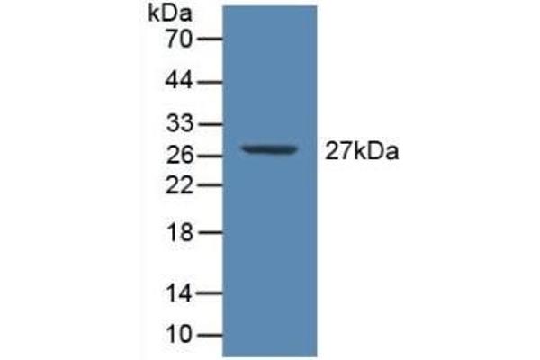CRP Antikörper  (AA 17-224)
