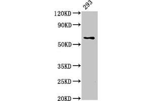 Western Blot Positive WB detected in: 293 whole cell lysate All lanes: LPCAT2 antibody at 5 μg/mL Secondary Goat polyclonal to rabbit IgG at 1/50000 dilution Predicted band size: 61, 31 kDa Observed band size: 61 kDa (LPCAT2 Antikörper  (AA 442-544))