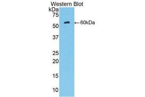 Western Blotting (WB) image for anti-Mannose-Binding Lectin (Protein C) 2, Soluble (MBL2) (AA 130-248) antibody (ABIN3206585) (MBL2 Antikörper  (AA 130-248))