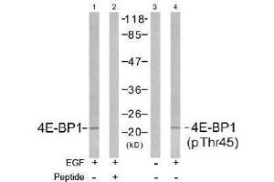 Image no. 2 for anti-Eukaryotic Translation Initiation Factor 4E Binding Protein 1 (EIF4EBP1) (pThr45) antibody (ABIN196966) (eIF4EBP1 Antikörper  (pThr45))