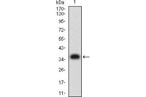 Western blot analysis using PLXNA1 mAb against human PLXNA1 (AA: 1100-1200) recombinant protein. (Plexin A1 Antikörper  (AA 1100-1200))
