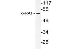 Western blot (WB) analyzes of c-RAF antibody in extracts from K562 cells. (RAF1 Antikörper)