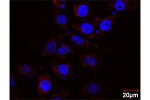 Proximity Ligation Assay (PLA) image for AKT1 & SMAD3 Protein Protein Interaction Antibody Pair (ABIN1340030)