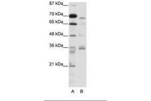 Image no. 1 for anti-Proprotein Convertase Subtilisin/kexin Type 6 (PCSK6) (AA 301-350) antibody (ABIN202833) (PCSK6 Antikörper  (AA 301-350))