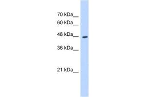 Western Blotting (WB) image for anti-Hydroxyacyl-CoA Dehydrogenase/3-Ketoacyl-CoA Thiolase/enoyl-CoA Hydratase (Trifunctional Protein), beta Subunit (HADHB) antibody (ABIN2463135) (HADHB Antikörper)